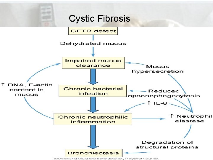 Cystic Fibrosis Cystic Fibrosis