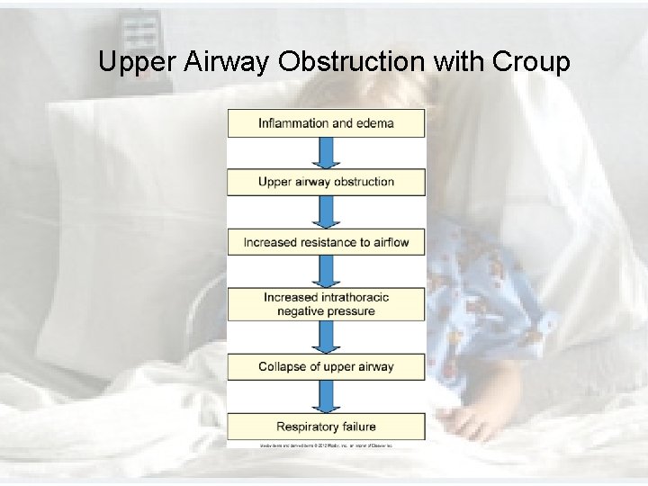 Upper Airway Obstruction with Croup Upper Airway Obstruction with Croup