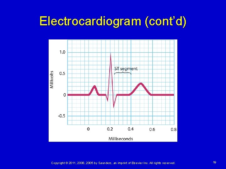 Electrocardiogram (cont’d) Copyright © 2011, 2008, 2005 by Saunders, an imprint of Elsevier Inc.