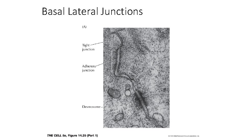 Basal Lateral Junctions 