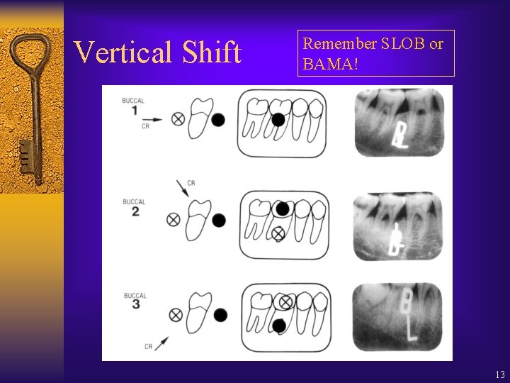 Vertical Shift Remember SLOB or BAMA! 13 Vertical Shift Remember SLOB or BAMA! 13