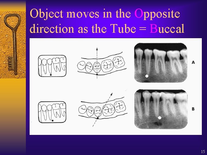 Object moves in the Opposite direction as the Tube = Buccal 15 Object moves in the Opposite direction as the Tube = Buccal 15