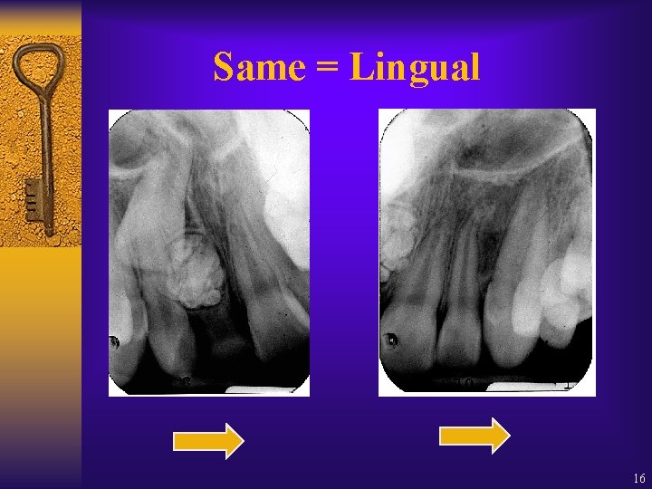 Same = Lingual 16 Same = Lingual 16