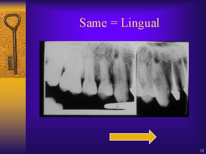 Same = Lingual 18 Same = Lingual 18
