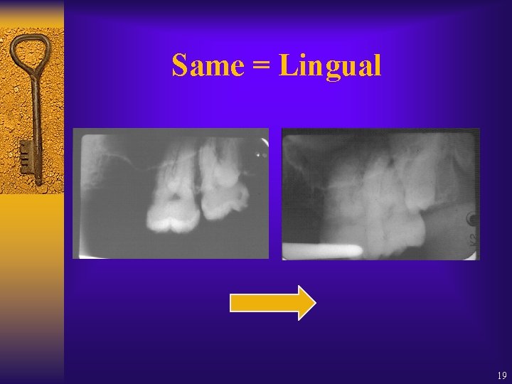 Same = Lingual 19 Same = Lingual 19