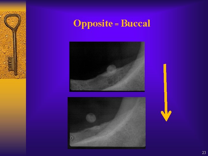 Opposite = Buccal 23 Opposite = Buccal 23