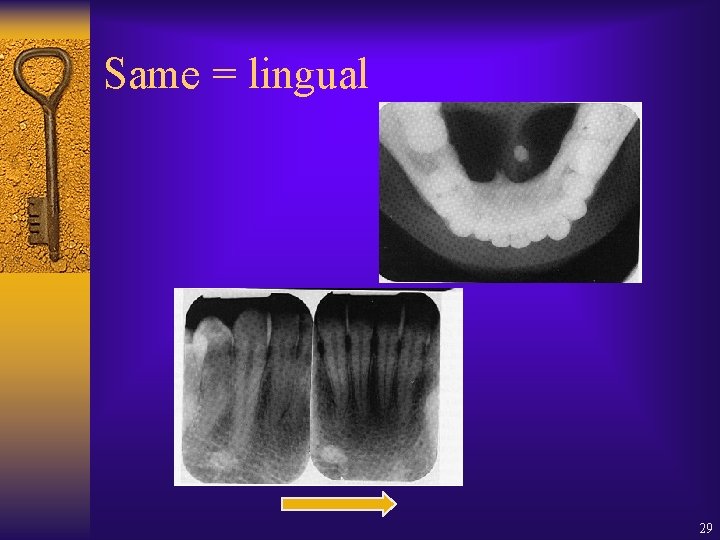 Same = lingual 29 Same = lingual 29