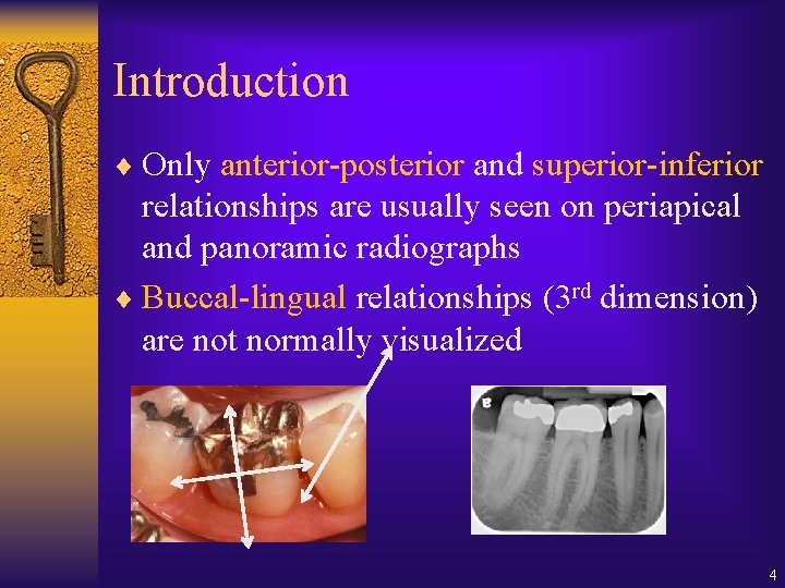 Introduction ¨ Only anterior-posterior and superior-inferior relationships are usually seen on periapical and panoramic Introduction ¨ Only anterior-posterior and superior-inferior relationships are usually seen on periapical and panoramic