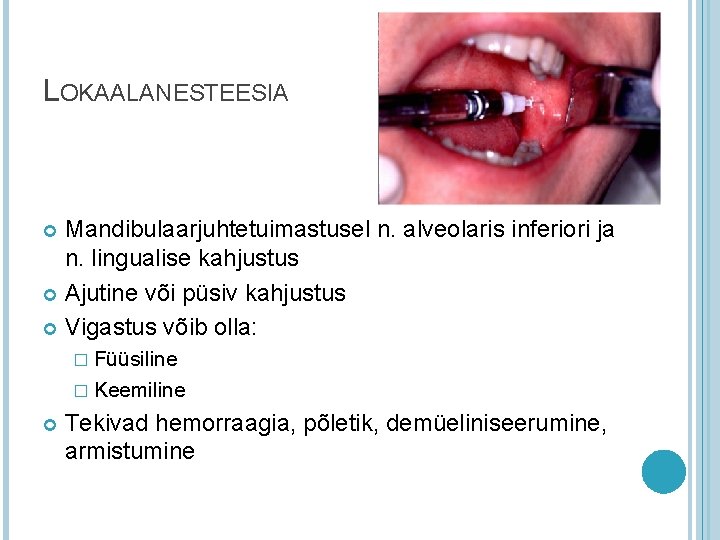 LOKAALANESTEESIA Mandibulaarjuhtetuimastusel n. alveolaris inferiori ja n. lingualise kahjustus Ajutine või püsiv kahjustus Vigastus LOKAALANESTEESIA Mandibulaarjuhtetuimastusel n. alveolaris inferiori ja n. lingualise kahjustus Ajutine või püsiv kahjustus Vigastus