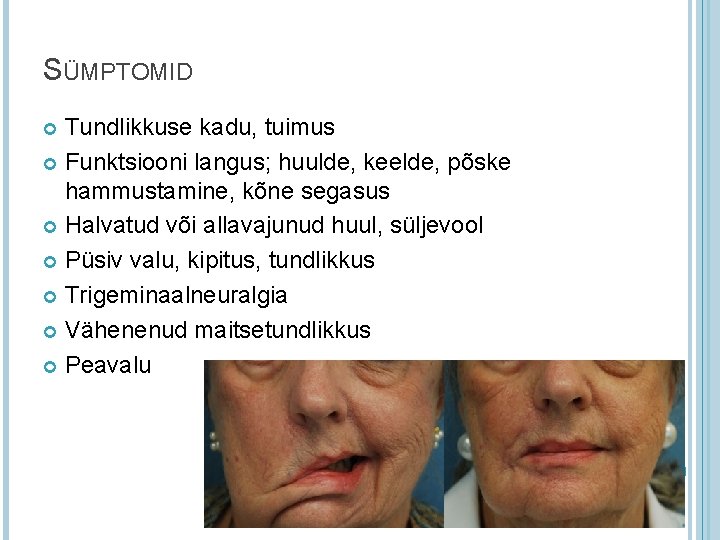 SÜMPTOMID Tundlikkuse kadu, tuimus Funktsiooni langus; huulde, keelde, põske hammustamine, kõne segasus Halvatud või SÜMPTOMID Tundlikkuse kadu, tuimus Funktsiooni langus; huulde, keelde, põske hammustamine, kõne segasus Halvatud või