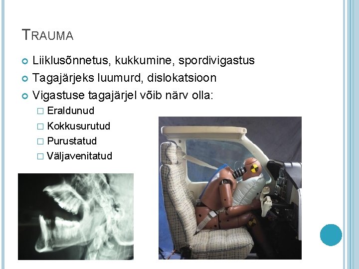 TRAUMA Liiklusõnnetus, kukkumine, spordivigastus Tagajärjeks luumurd, dislokatsioon Vigastuse tagajärjel võib närv olla: � Eraldunud TRAUMA Liiklusõnnetus, kukkumine, spordivigastus Tagajärjeks luumurd, dislokatsioon Vigastuse tagajärjel võib närv olla: � Eraldunud