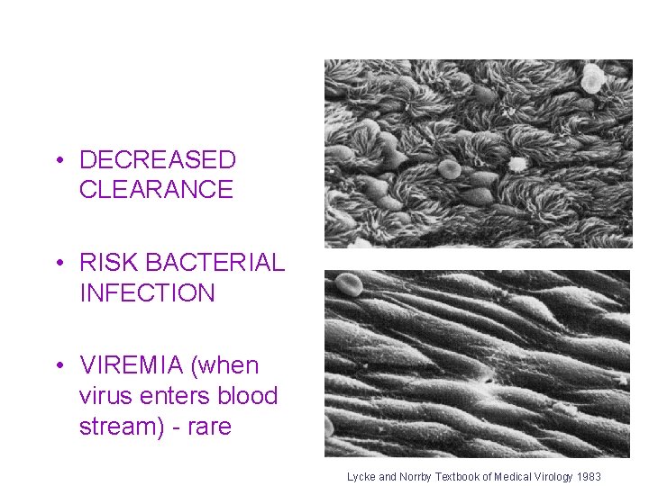  • DECREASED CLEARANCE • RISK BACTERIAL INFECTION • VIREMIA (when virus enters blood