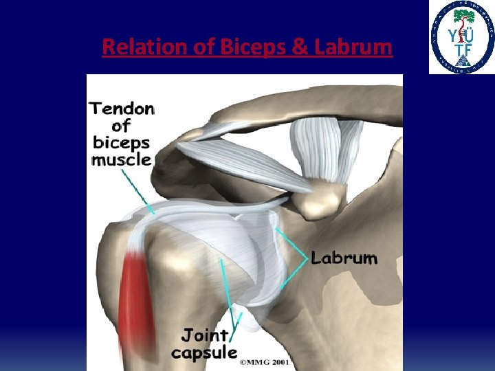 Relation of Biceps & Labrum 