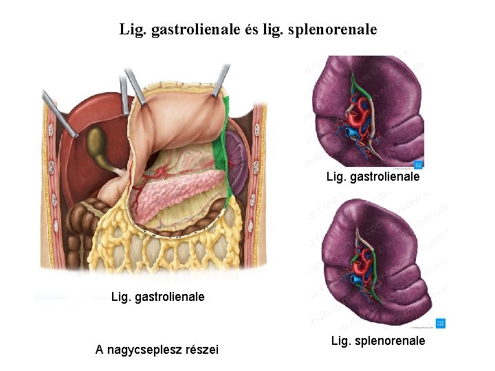 Lig. gastrolienale és lig. splenorenale Lig. gastrolienale A nagycseplesz részei Lig. splenorenale 