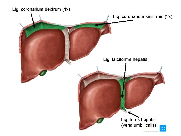 Lig. coronarium dextrum (1 x) Lig. coronarium sinistrum (2 x) Lig. falciforme hepatis Lig.