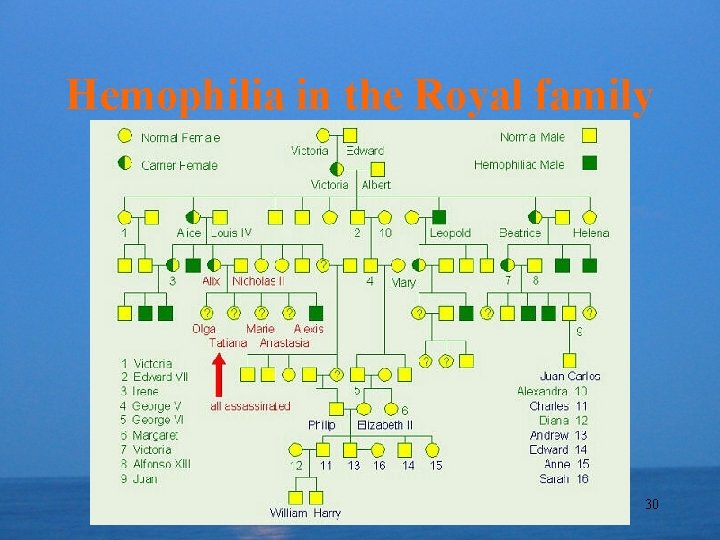 Hemophilia in the Royal family 30 