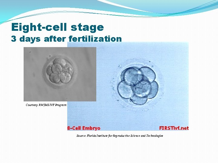 Eight-cell stage 3 days after fertilization Courtesy: RWJMS IVF Program Source: Florida Institute for