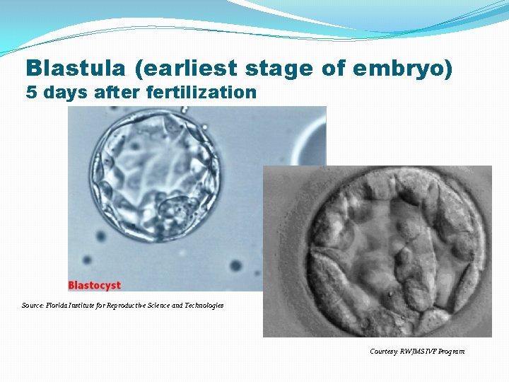 Blastula (earliest stage of embryo) 5 days after fertilization Source: Florida Institute for Reproductive Blastula (earliest stage of embryo) 5 days after fertilization Source: Florida Institute for Reproductive