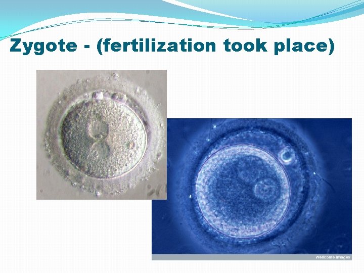 Zygote - (fertilization took place) Zygote - (fertilization took place)