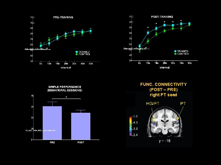 FUNC. CONNECTIVITY (POST – PRE) right PT seed 