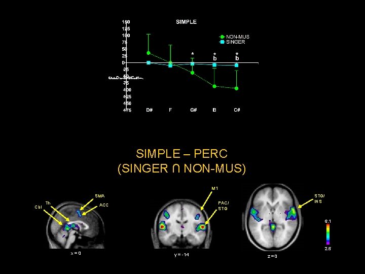 SIMPLE – PERC (SINGER ∩ NON-MUS) M 1 STG/ INS SMA Cbl Th PAC/