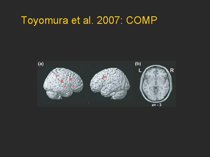 Toyomura et al. 2007: COMP 