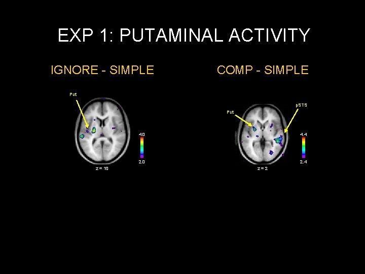 EXP 1: PUTAMINAL ACTIVITY IGNORE - SIMPLE COMP - SIMPLE Put p. STS Put