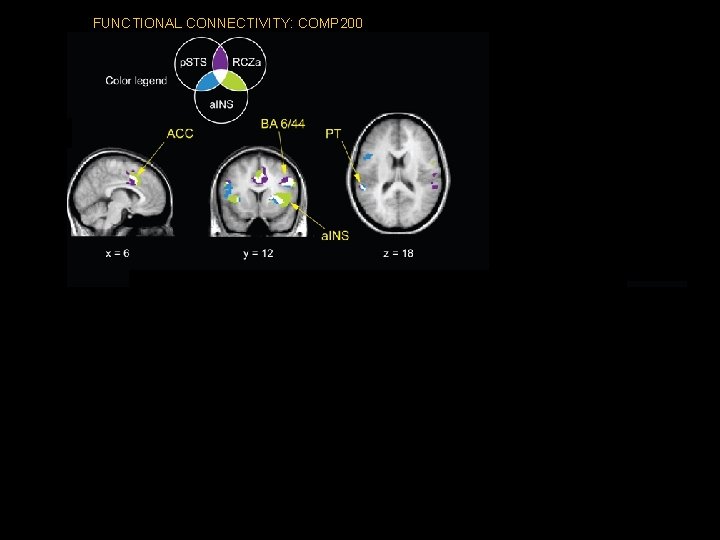 FUNCTIONAL CONNECTIVITY: COMP 200 EFFECTIVE CONNECTIVITY: COMP 200 (vs. SIMPLE) p. STS seed EFFECTIVE