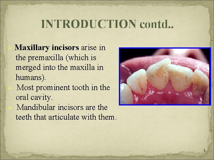 INTRODUCTION contd. . Maxillary incisors arise in the premaxilla (which is merged into the