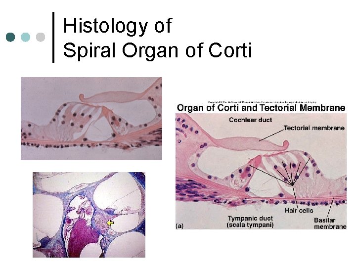 Histology of Spiral Organ of Corti 