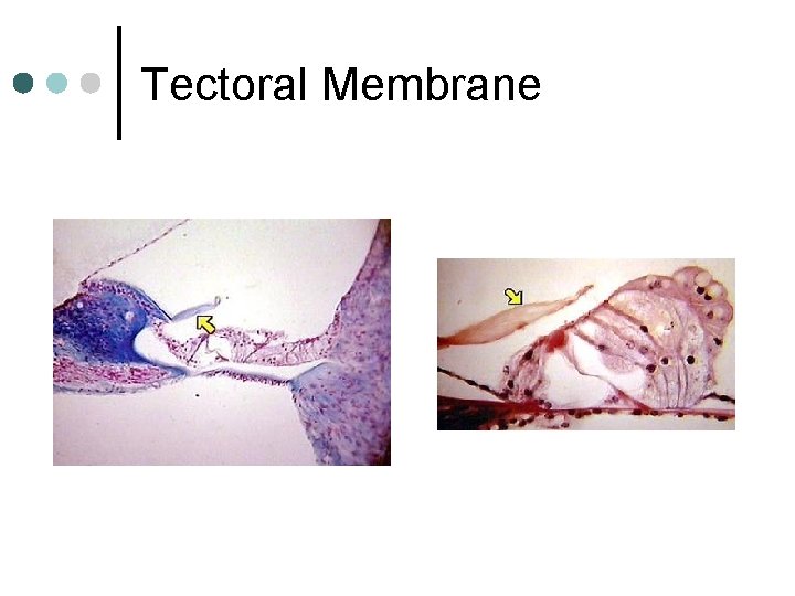 Tectoral Membrane 