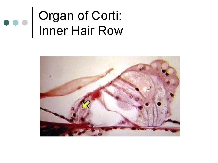 Organ of Corti: Inner Hair Row 