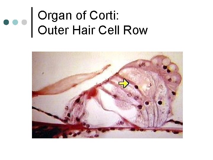 Organ of Corti: Outer Hair Cell Row 