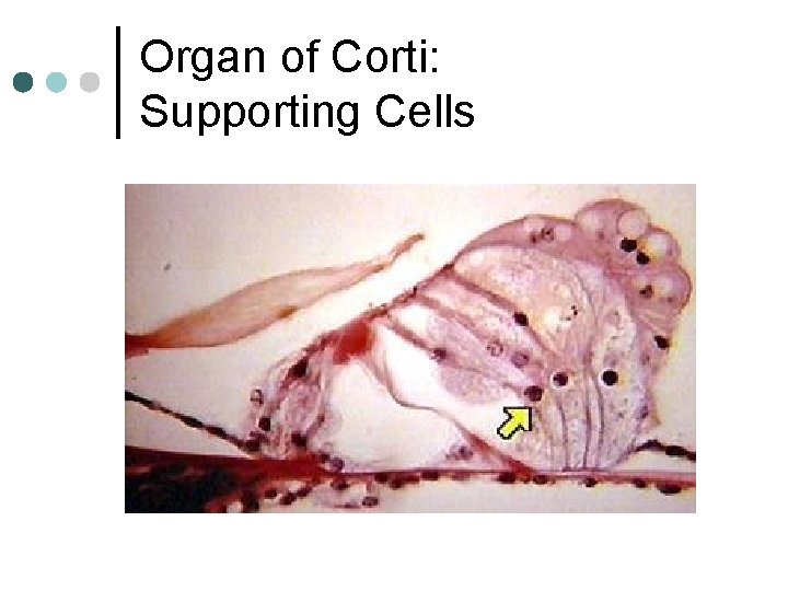 Organ of Corti: Supporting Cells 