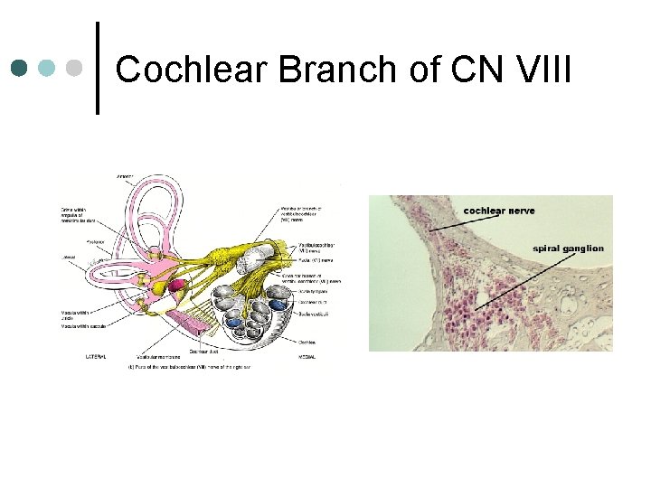 Cochlear Branch of CN VIII 