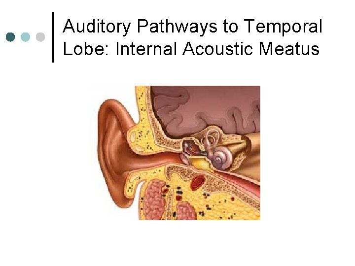 Auditory Pathways to Temporal Lobe: Internal Acoustic Meatus 