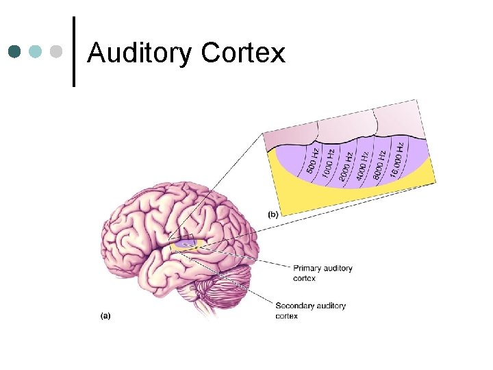 Auditory Cortex 