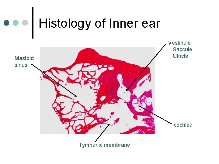 Histology of Inner ear Vestibule Saccule Utricle Mastoid sinus cochlea Tympanic membrane 