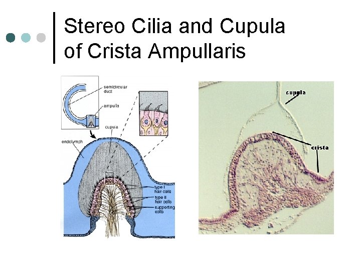 Stereo Cilia and Cupula of Crista Ampullaris 