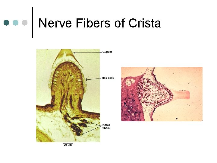 Nerve Fibers of Crista 