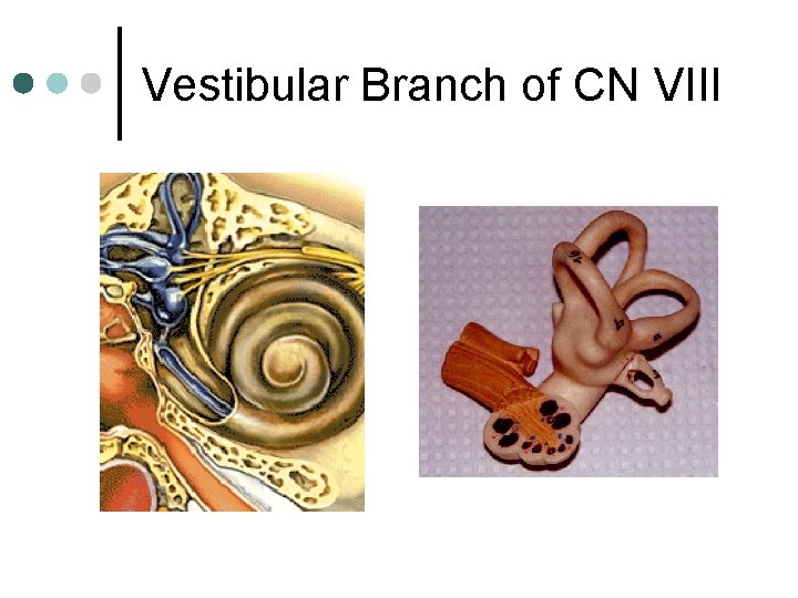 Vestibular Branch of CN VIII 