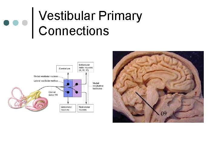 Vestibular Primary Connections 