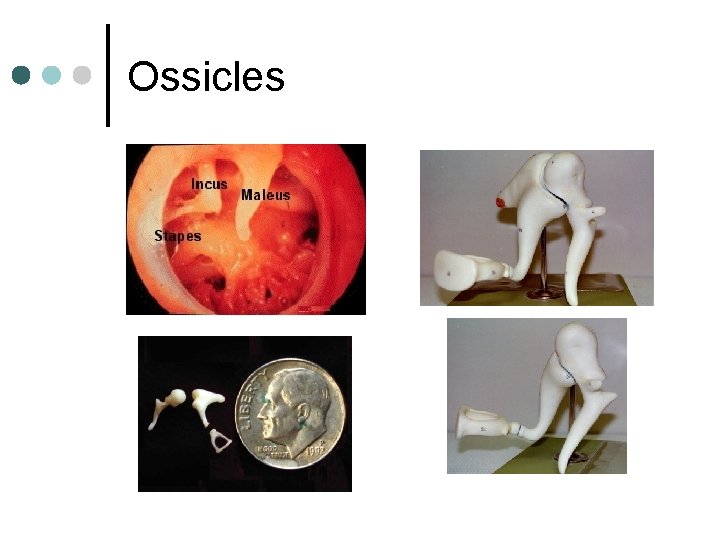Ossicles 