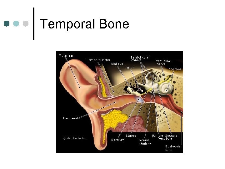 Temporal Bone 