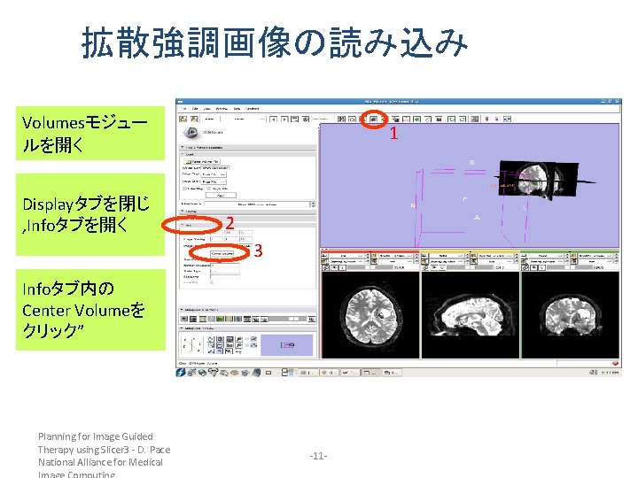 拡散強調画像の読み込み Volumesモジュー ルを開く Displayタブを閉じ , Infoタブを開く 1 2 3 Infoタブ内の Center Volumeを クリック” Planning