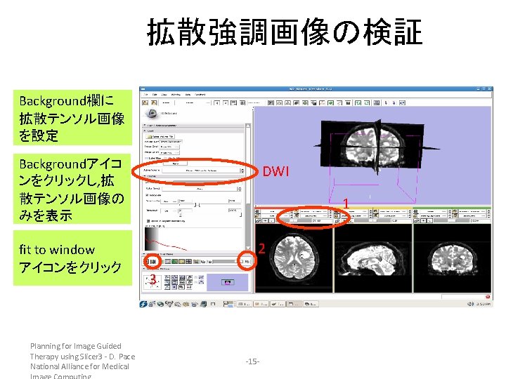 拡散強調画像の検証 Background欄に 拡散テンソル画像 を設定 Backgroundアイコ ンをクリックし, 拡 散テンソル画像の みを表示 fit to window アイコンをクリック Planning