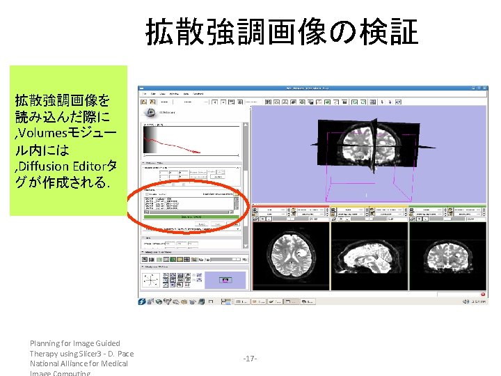 拡散強調画像の検証 拡散強調画像を 読み込んだ際に , Volumesモジュー ル内には , Diffusion Editorタ グが作成される. Planning for Image Guided