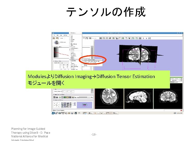 テンソルの作成 ModulesよりDiffusion Imaging→Diffusion Tensor Estimation モジュールを開く Planning for Image Guided Therapy using Slicer 3