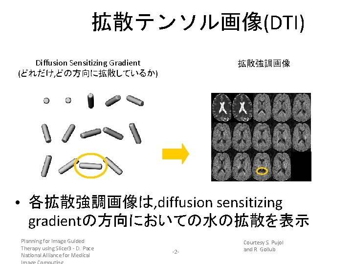 拡散テンソル画像(DTI) Diffusion Sensitizing Gradient (どれだけ, どの方向に拡散しているか) 拡散強調画像 • 各拡散強調画像は, diffusion sensitizing gradientの方向においての水の拡散を表示 Planning for