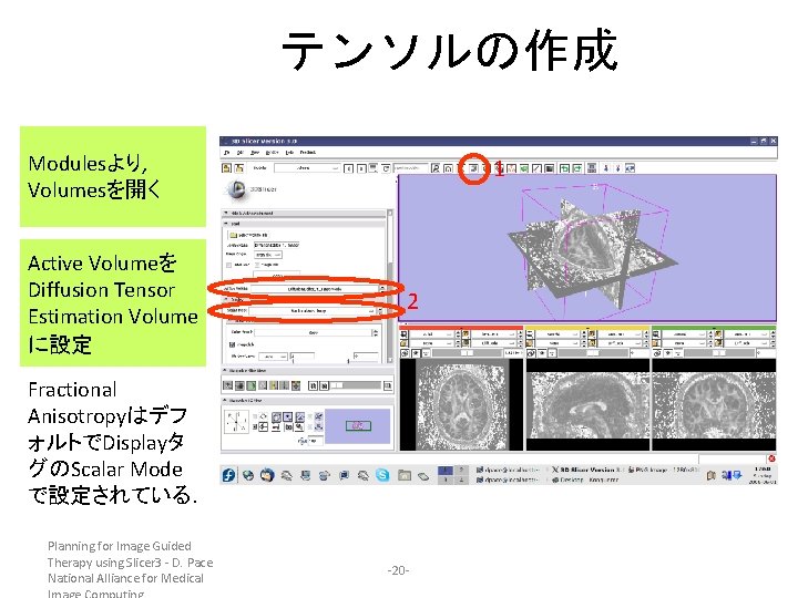 テンソルの作成 Modulesより, Volumesを開く Active Volumeを Diffusion Tensor Estimation Volume に設定 1 2 Fractional Anisotropyはデフ